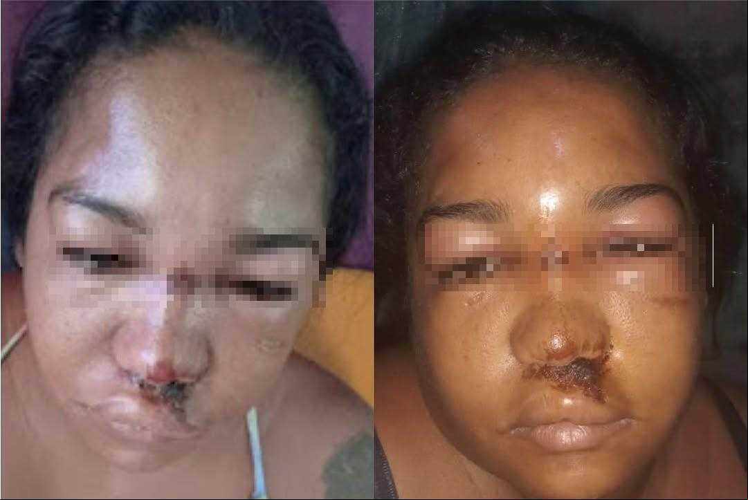 Mulher é espancada pelo marido com golpes de capacete e socos